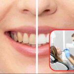 Consigli per evitare l'ingiallimento dei denti