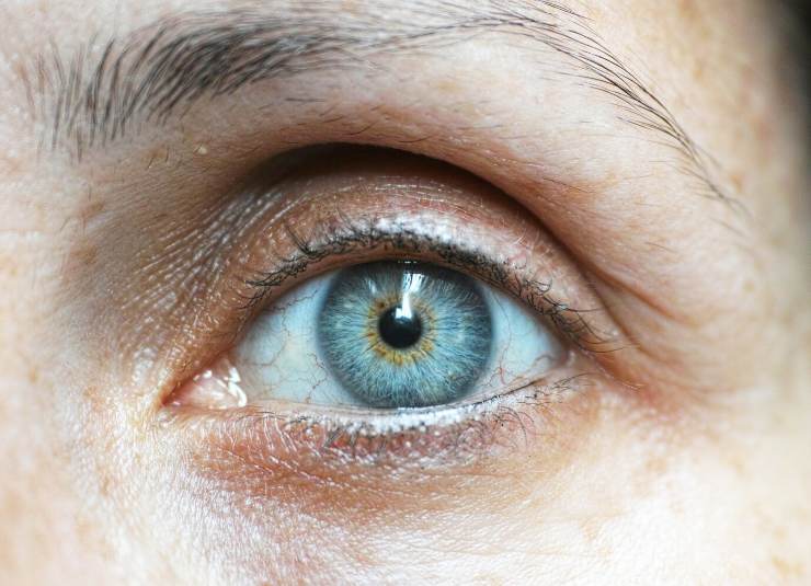 Boom di infezioni agli occhi e cecità